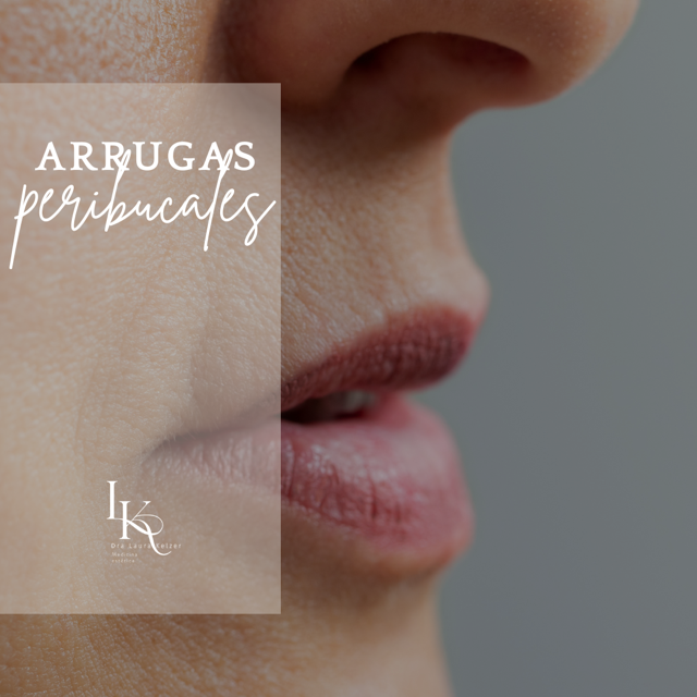 arrugas-peribucales