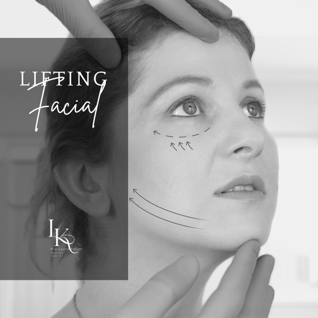 lifting-facial